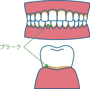 プラーク